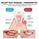 thumbnail image 4 of Teeth Repair Gel, Oral Repair Gel, Healthy Gums, Breath Freshener, Stain Removes, Strengthens Teeth, Oral Care Cleaner, v34 Whitening Gel, 4 of 5