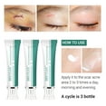 Advanced Scar Cream Scar Treatment for Surgical Scars, for Face,Keloids, CSection, Cosmetic