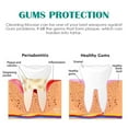 thumbnail image 5 of Espuma de limpieza dental Espuma de limpieza bucal Fresh Oral Cleaning Care 30 ml pasta de dientes pasta de dientes, 5 of 5