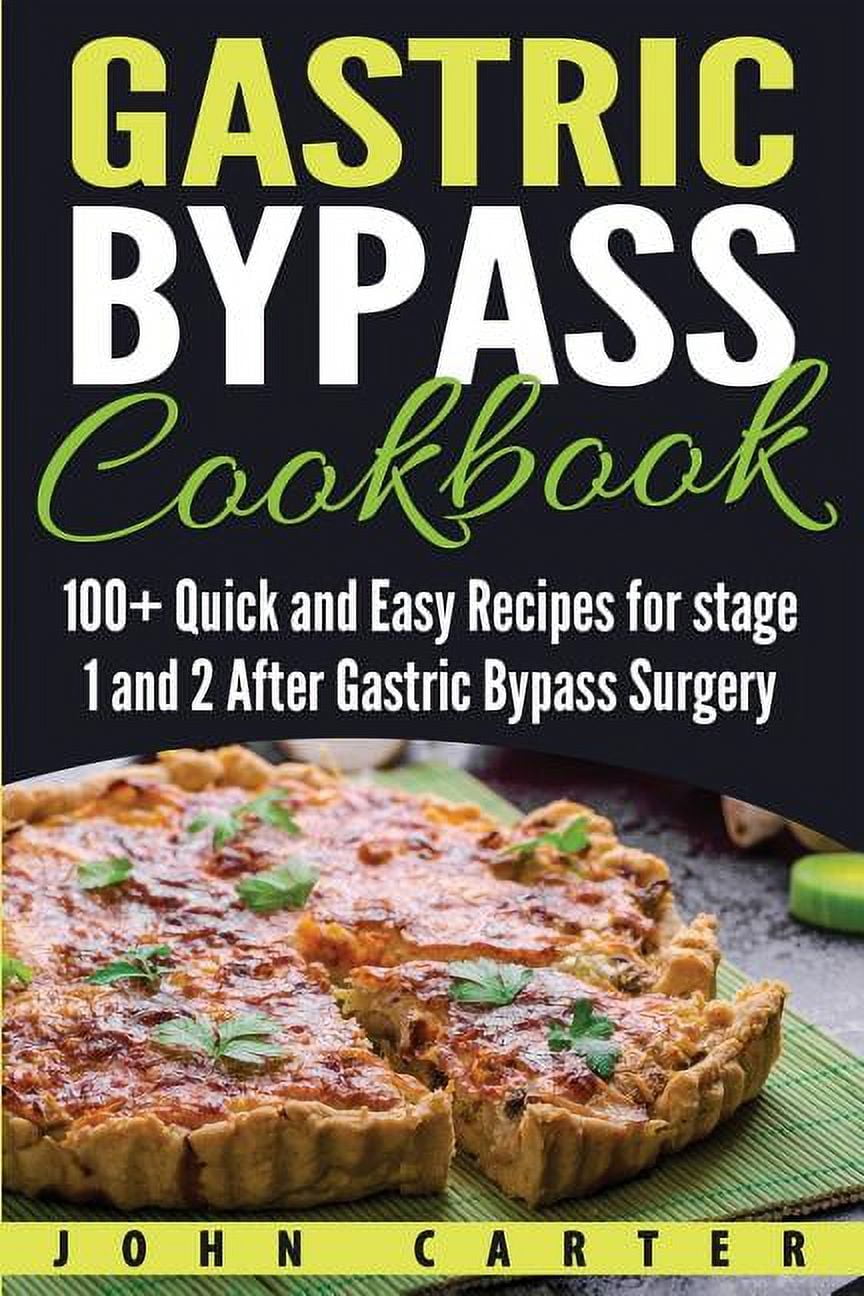 Gastric Bypass Cookbook: MEGA BUNDLE - 4 Manuscripts In 1 - 160+ Gastric Bypass - Friendly Recipes Including Breakfast, Side Dishes, And Desserts For A Delicious And Tasty Diet: 9781664049338: Nomad Publishing