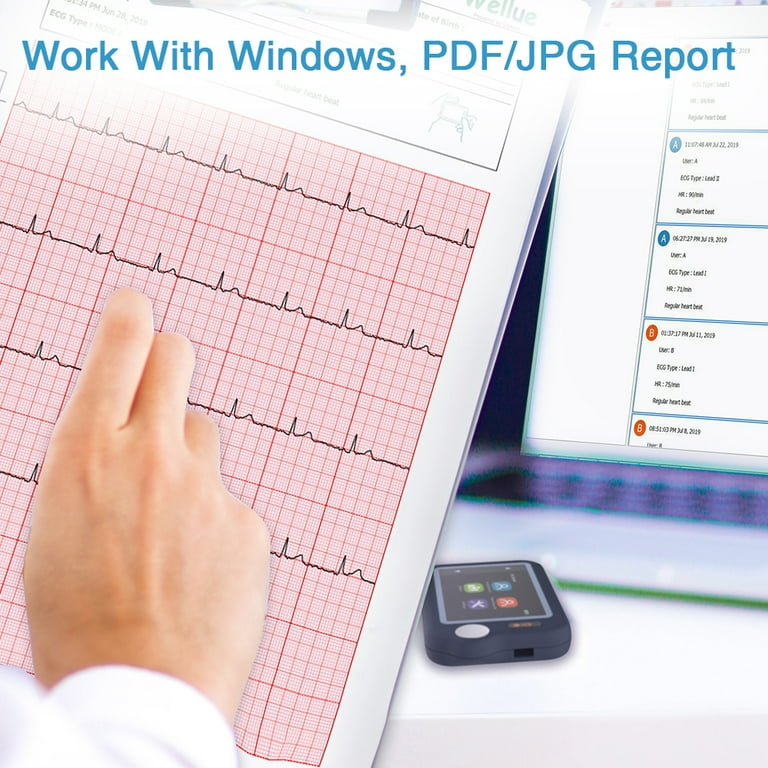 Walmart Black Friday Deals 2025 - Checkme Pulsebit EX AI ECG