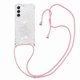 thumbnail image 5 of Funda FOXDOCK para Samsung Galaxy S20 con Cuerda Ajustable, Brillo Líquido, Protección Antigolpes y Lente – Ideal para Regalo, 5 of 6