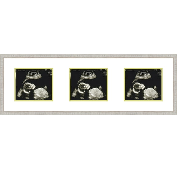 16x5 Rustic White Sonogram Frame with White on Green Mats with 3 Openings to Display 3 4x3