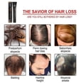 thumbnail image 3 of Loción para cabello largo y espeso con bola de rodillo de masaje Eelhoe -3122820341280, 3 of 5