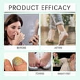 thumbnail image 5 of Foot Sanitizer Spray with Tea Tree Oil, Tea Tree Oil Foot Spray, 5 of 5