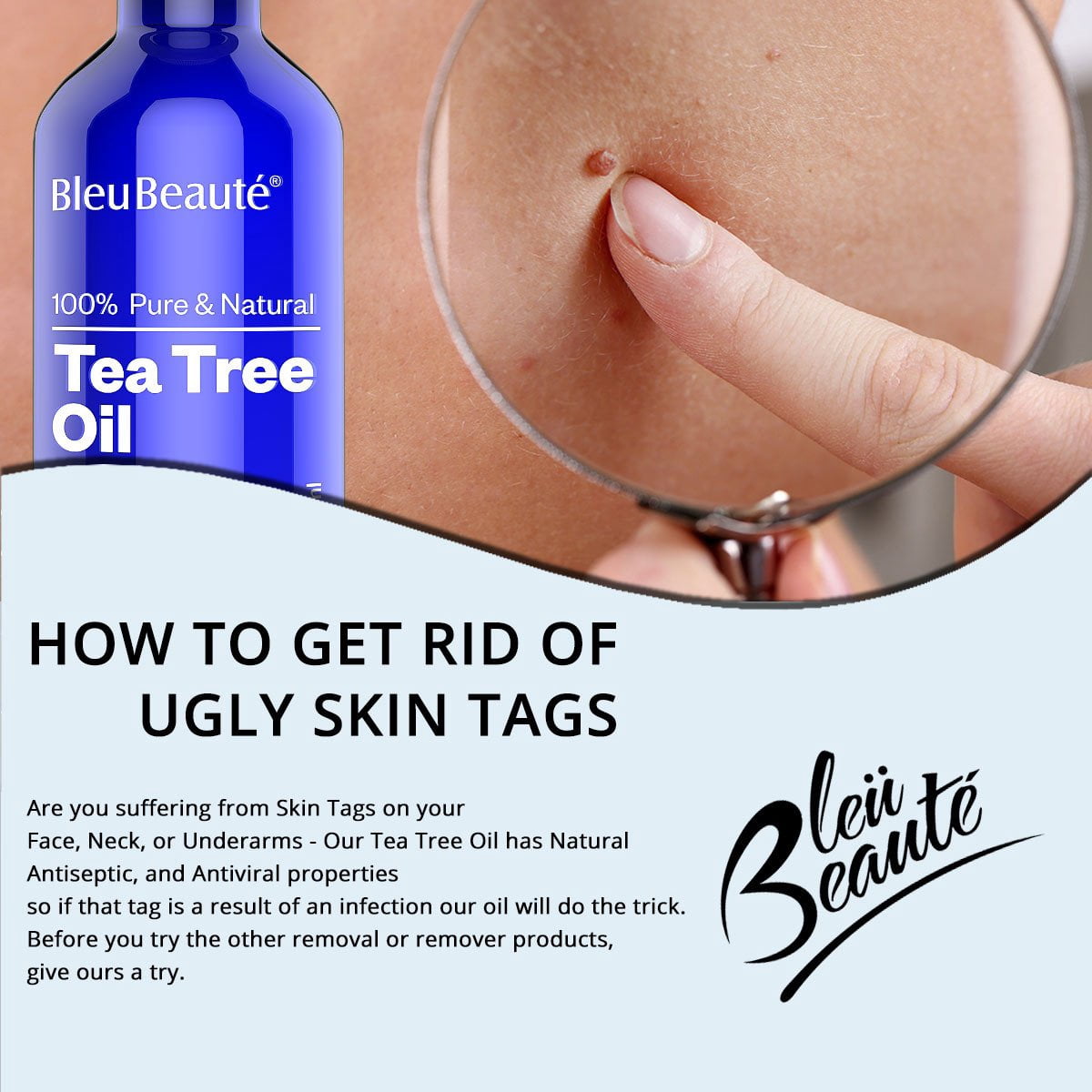 Tea Tree Oil Used For Mole And Skin Tag Removal Walmart Com Walmart Com