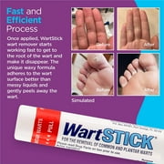Wart Stick Painless & Odorless Solid Wart Stick Remover, Maximum Strength, 0.2 oz, 5 Pack