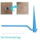 thumbnail image 2 of Juego de removedor de etiquetas de piel Kit de eliminación de etiquetas de piel con piel Labymos Removedor de etiquetas de piel, 2 of 5