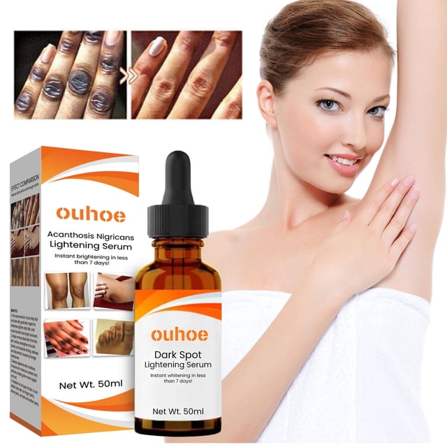 suero aclarador xihbxyly para acantosis nigricans crema facial hidratante 50 ml — botella con gotero y caja del producto sobre fondo blanco, indicación de 50 ml visible; imagen compuesta incluye modelo con axila mostrada y comparativa antes/después de zonas oscuras en piel; suero facial para reducir manchas y poros según etiqueta; a menudo usado también para tratar pequeñas zonas hiperpigmentadas de la cara o el cuello.