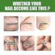 thumbnail image 4 of South Moon Nail Care Roller Balls - Nourishing Massage For Stronger, Faster-growing Nails With 7-day Nail Growth Formula, 4 of 5