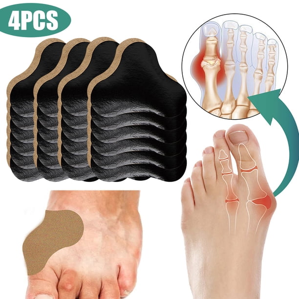 6 Uds Hallux Valgus Parches Corrección Juanetes para Pies Herramientas Pedicura El Cuidado