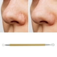 thumbnail image 5 of Unique Bargains 1pc Portable Double-Headed Pimple Extractor Tool Gold Tone, 5 of 6