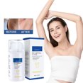 thumbnail image 3 of Crema blanqueadora de piel Xihbxyly 30 ml para axilas y rodillas, 3 of 7