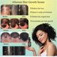 thumbnail image 3 of Sérum para el crecimiento del cabello para mujeres y hombres afroamericanos, cabello más grueso y abundante, nutre el cuero cabelludo, 3 piezas, 3 of 5