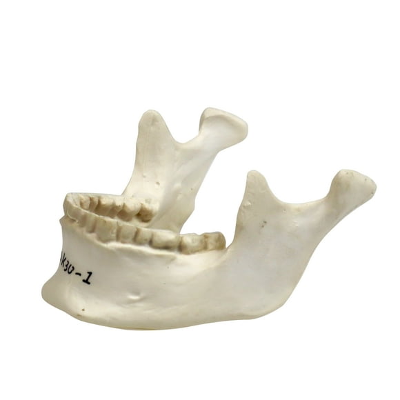 Isaac Technologies IC-B10251 22-Part Totally Disarticulated Plastic Skull