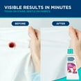 thumbnail image 5 of Carbona Stain Devils® #4 | Blood, Dairy & Ice Cream | Professional Strength Laundry Stain Remover | Multi-Fabric Cleaner | Safe On Skin & Washable Fabrics | 1.7 Fl Oz, 3 Pack, 5 of 8