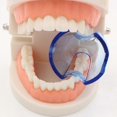 thumbnail image 2 of Mouth Opener Dental Orthodontic Braces Lip Cheek Retractor Expander Dental Mouth Oral Tooth Tool Care Orthodontic Accessory, 2 of 5