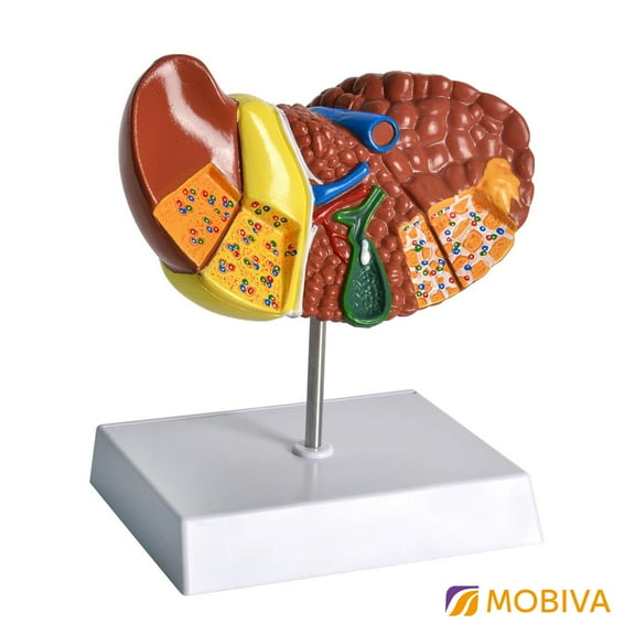 Human Anatomical Pathology Liver Model, Features Liver Cirrhosis Model