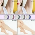 thumbnail image 5 of Hair Eraser Remover for Women Men Smooth Exfoliation Legs Body Hair Removal Tool Reusable, 5 of 7