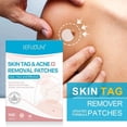 thumbnail image 2 of Ingredients And Effective Remover Tag 108PCS Removal Tag And Skin Improved Patch-Skin Removal Patches, Quick and Effective Removal Sticker for All Kinds of Skin, Friendly to New-User,Patch,1pack, 2 of 8