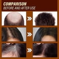 thumbnail image 4 of Ginger Hair Growth Essence Moisturizing And urishing Strength Repair Hair Follicle Damage Dry And, 4 of 5