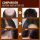 thumbnail image 4 of Ginger Hair Growth Essence Moisturizing And urishing Strength Repair Hair Follicle Damage Dry And, 4 of 5