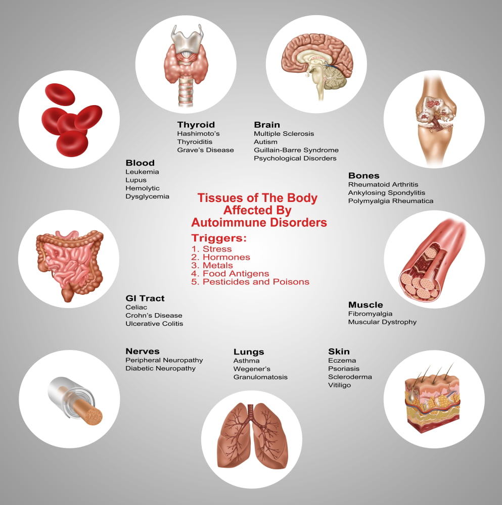 24 x 24 Eczema Poster Print by Gwen ShockeyScience Source 