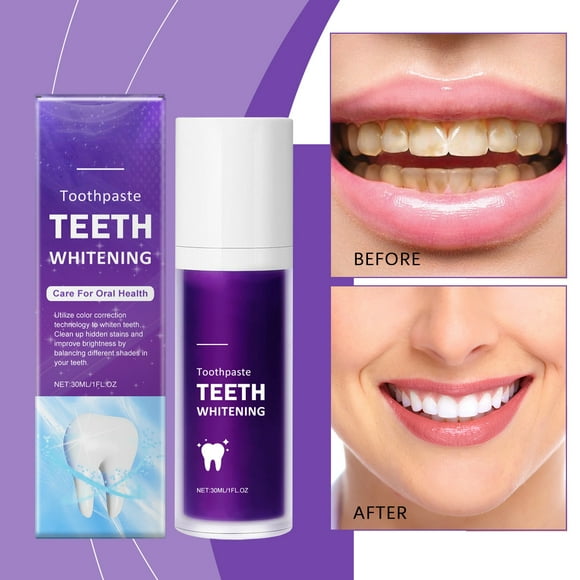 Purple Toothpaste Teeth Removing Yellow Stains Toothpaste Tooth Enamel And Promotes Teeth