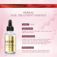 thumbnail image 6 of Lenkho Nail Fungus Liquid, Fungal Nail Polish for Toenails & Fingernails, Nail Treatment Oil, Supports Nail Growth, Restores the Natural Appearance of Nails, Gentle on Nails, 6 of 9