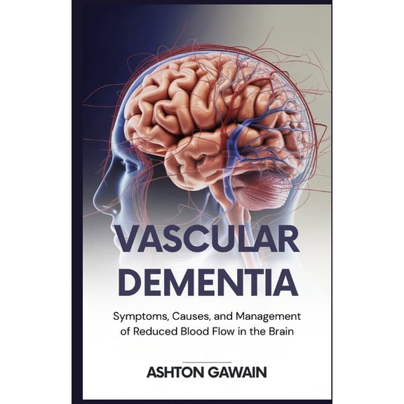 Vascular Dementia: Symptoms, Causes, and Management of Reduced Blood Flow in the Brain, (Paperback)