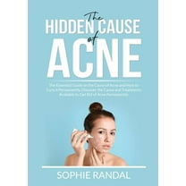 The Hidden Cause of Acne: The Essential Guide on the Cause of Acne and How to Cure it Permanently, Discover the Cause an, (Paperback)