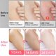 thumbnail image 3 of Crema reparadora de piel de pollo, loción de suero suave hidratante, elimina los poros gruesos, elimina las manchas oscuras del cuerpo, queratosis, folículo Pilaris, 3 of 5