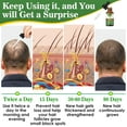 thumbnail image 3 of Rosemary Essential Oil for Hair Growth,Pure Organic Hair Care Oil for Hair Loss,Scalp Massager, 3 of 9