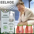 thumbnail image 4 of Espray Herbal Natural para hemorroides, tratamiento de la inflamación, heces sangrientas, espray para hemorroides externas y fisuras, 30ml, 4 of 5