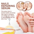 thumbnail image 3 of 2PCS Nail Repair Serum Fungal Nail Treatment Liquid Remove Onychomycosis Toe Essence, 3 of 5