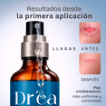 thumbnail image 3 of Agatha - Gel dermolimpiador para piel expuesta, comprometida y con lesiones recurrentes, 3 of 5