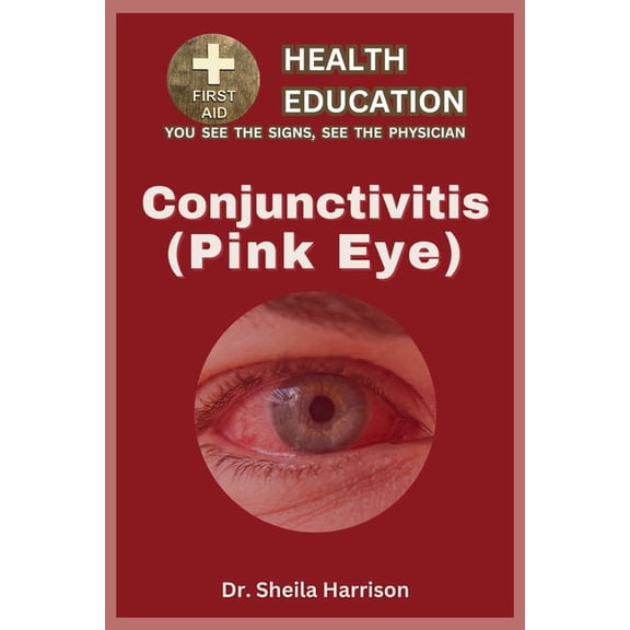 Sheila's Health Education Book Shelf: You See the Signs, See the Physician: Pink Eye (Conjunctivitis): Types, Symptoms, Causes, Diagnosis, Treatment, Medications, Prevention & Control, Management (Pap