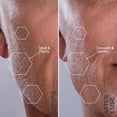 thumbnail image 5 of MICHAEL TODD Beauty - Sonicsmooth – SONIC Technology Dermaplaning Tool - 2 in 1 Women’s Facial Exfoliation & Peach Fuzz Hair Removal System with 8 Weeks of Dermaplaning Blades, 5 of 9