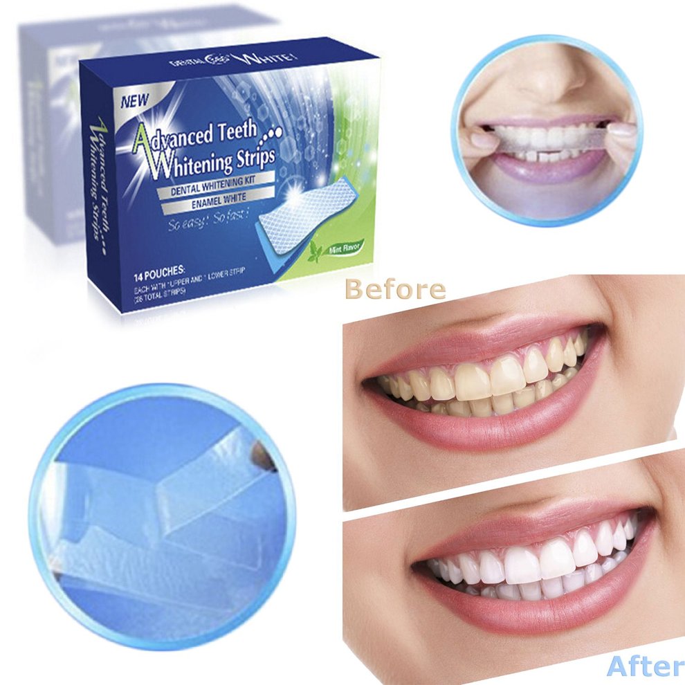 natural white advanced teeth whitening