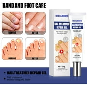 Seniver Anti Fungal Nail Gel, Anti Effective Nail Care, Anti Infection Nail Care, Hand and Foot Gentle Non Iritation Nail Essence