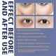 thumbnail image 4 of Jaysuing Active Eye Cream - Anti-wrinkle, Circle Removal, And Eye Bag Reduction | |, 4 of 4