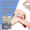 thumbnail image 5 of Soothing Moisturizing Psoriasises Liquid Portable Anti-itch Body Care Liquids Body Care Supplies, 5 of 5