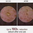 thumbnail image 2 of Peel Shot Glow Exfoliant Rice Ampoule (white Rice/black Rice), 2 of 5