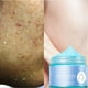 thumbnail image 5 of crema exfoliante exfoliante gel exfoliante cara cuerpo gel hidratante Limpiador facial Cara Cuerpo Hidratante Blanqueador Crema Exfoliante Exfoliante Piel Peeling Gel 150g, 5 of 8