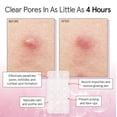 thumbnail image 3 of Pimple Patches Grace & Stella, HSA, 72 unidades, ganadores del premio FSA, 3 of 9