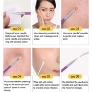 4 PCS Blackhead Remover Tool Kit, Tweezers Set for Face Defects, Blackhead Extractor tool for Face