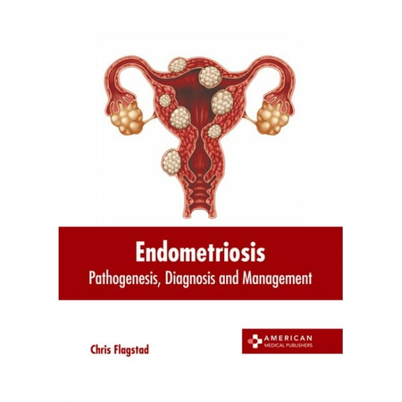 Endometriosis: Pathogenesis, Diagnosis and Management, (Hardcover)