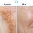 thumbnail image 3 of Crema OMIC con 10% de ácido tranexámico para iluminar la piel, 30 ml, con aceite de coco y vitamina E, 3 of 9