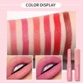 View all media
