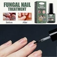 thumbnail image 3 of Extra Strength Nail Repair Fluid - Natural Toenail & Nail Fungus Cure, Discoloration Damage Repair, Anti-Paronychia Solution, 3 of 5
